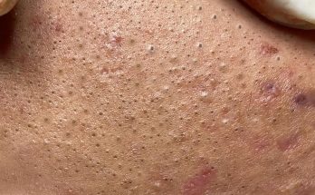 Most Satisfying and Relaxation with An Spa Video