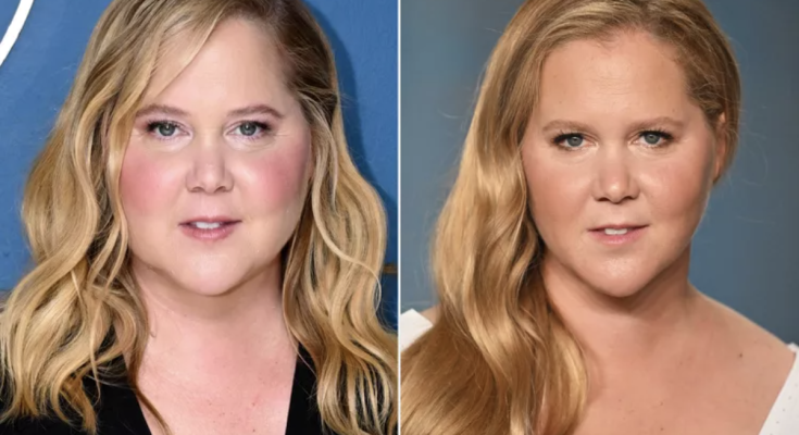 Amy Schumer Says Comments About Her 'Moon Face' Led to Cushing Syndrome Diagnosis: 'I Wouldn't Have Known'