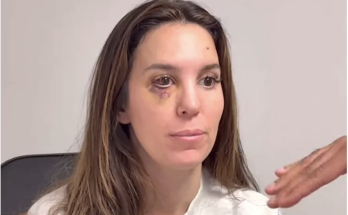 Christy Carlson Romano Says Bullet Fragment Was ‘Less Than 1 Millimeter’ from ‘Permanently Blinding’ Her