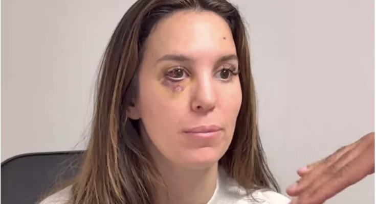 Christy Carlson Romano Says Bullet Fragment Was ‘Less Than 1 Millimeter’ from ‘Permanently Blinding’ Her